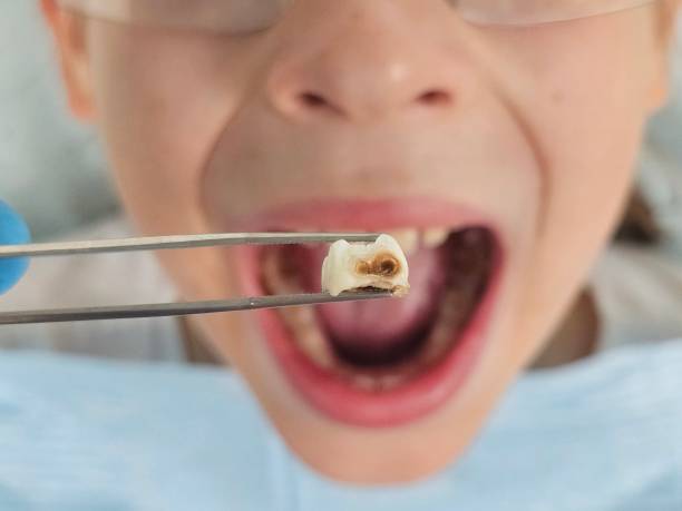 Best Pediatric Emergency Dentist in Yardley, PA